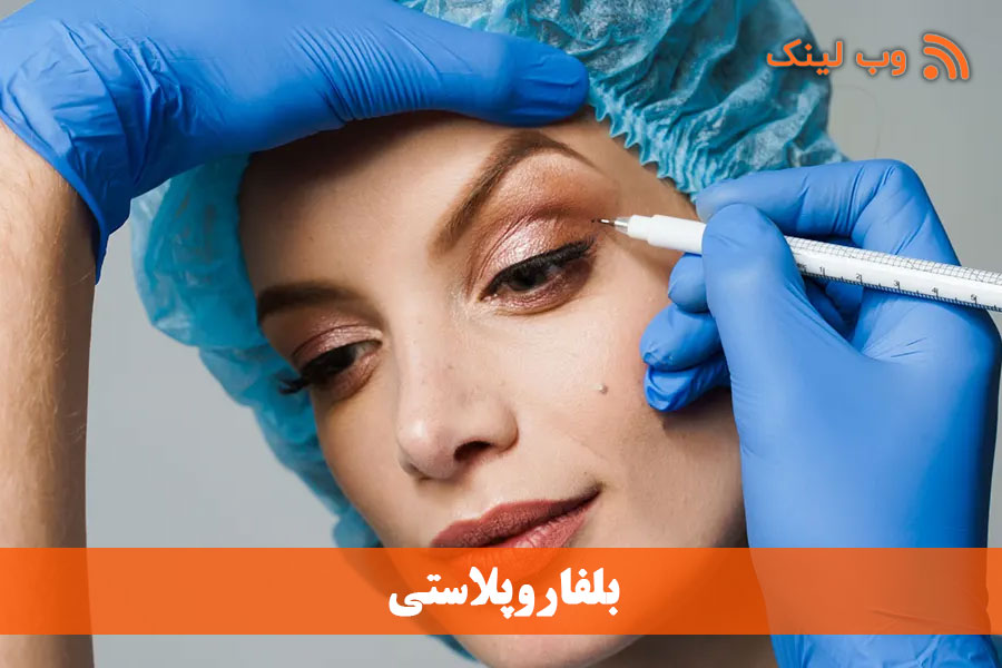 بلفاروپلاستی چگونه انجام می‌شود؟